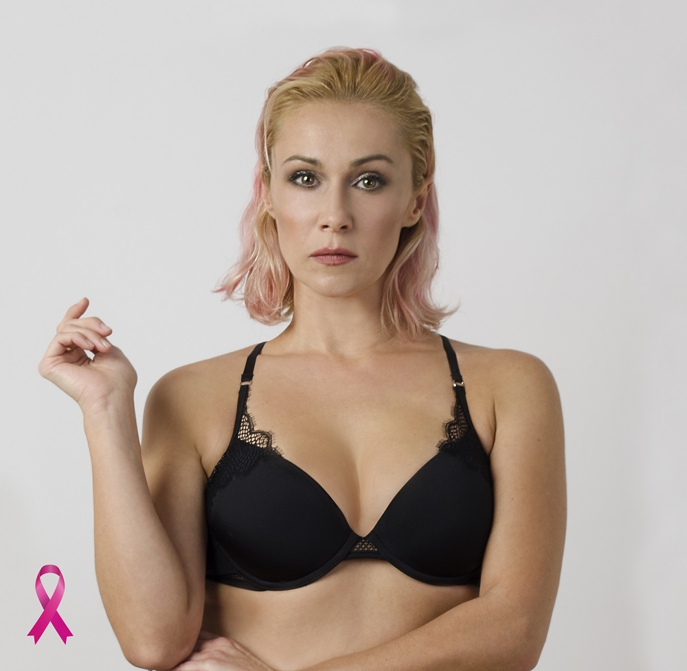 Mamografija Katerina Šehtanska Mamografija Katerina Šehtanska